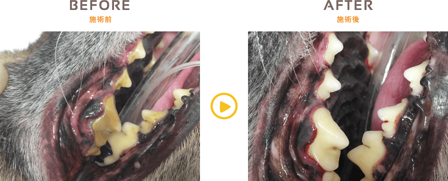 歯石除去の施術例